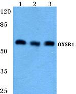 OXSR1 Antibody in Western Blot (WB)