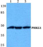 PHKG1 Antibody in Western Blot (WB)