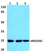 ARHGDIG Antibody in Western Blot (WB)