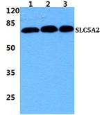 SGLT2 Antibody in Western Blot (WB)