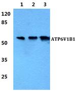 ATP6V1B1 Antibody in Western Blot (WB)