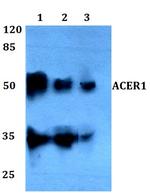 ASAH3 Antibody in Western Blot (WB)