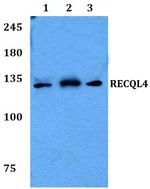 RECQ4 Antibody in Western Blot (WB)