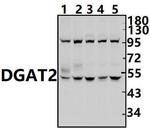 DGAT2 Antibody in Western Blot (WB)