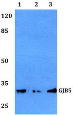 Connexin 31.1 Antibody in Western Blot (WB)