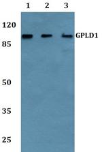 GPLD1 Antibody in Western Blot (WB)