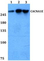 CaV2.3 Antibody in Western Blot (WB)