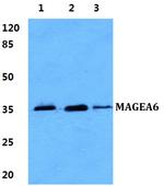 MAGEA6 Antibody in Western Blot (WB)