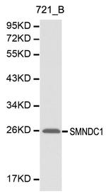 SMNDC1 Antibody in Western Blot (WB)