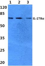 TCCR Antibody in Western Blot (WB)