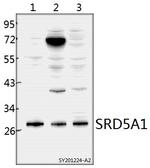 SRD5A1 Antibody in Western Blot (WB)