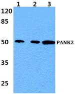 PANK2 Antibody in Western Blot (WB)