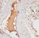 Apolipoprotein C1 Antibody in Immunohistochemistry (Paraffin) (IHC (P))