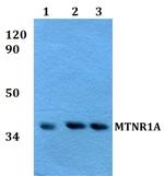 MTNR1A Antibody in Western Blot (WB)