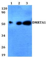 DMRTA1 Antibody in Western Blot (WB)