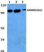 A20A1 Antibody in Western Blot (WB)