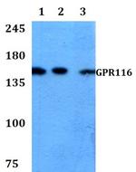 GPR116 Antibody in Western Blot (WB)