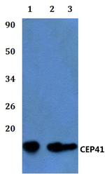 CEP41 Antibody in Western Blot (WB)