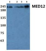 MED12 Antibody in Western Blot (WB)