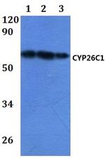 CYP26C1 Antibody in Western Blot (WB)