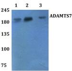 ADAMTS7 Antibody in Western Blot (WB)