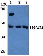 B4GALT2 Antibody in Western Blot (WB)