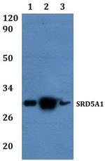 SRD5A1 Antibody in Western Blot (WB)