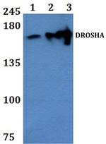 Drosha Antibody in Western Blot (WB)