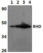 RHD Antibody in Western Blot (WB)