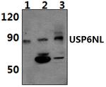 USP6NL Antibody in Western Blot (WB)