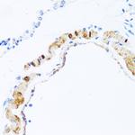 PHPT1 Antibody in Immunohistochemistry (Paraffin) (IHC (P))