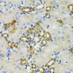 PHPT1 Antibody in Immunohistochemistry (Paraffin) (IHC (P))