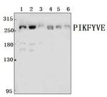 PIKFYVE Antibody in Western Blot (WB)