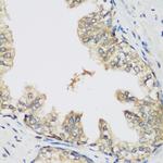 RRM1 Antibody in Immunohistochemistry (Paraffin) (IHC (P))