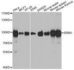 RRM1 Antibody in Western Blot (WB)