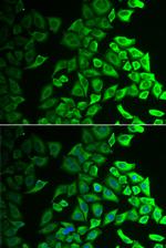 IL18BP Antibody in Immunocytochemistry (ICC/IF)