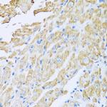 IL18BP Antibody in Immunohistochemistry (Paraffin) (IHC (P))