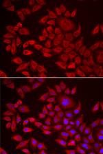 AGPAT2 Antibody in Immunocytochemistry (ICC/IF)