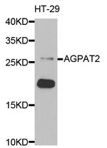 AGPAT2 Antibody in Western Blot (WB)