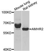 AMHR2 Antibody in Western Blot (WB)