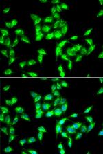 CMG2 Antibody in Immunocytochemistry (ICC/IF)