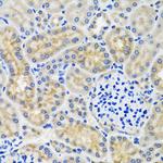 CMG2 Antibody in Immunohistochemistry (Paraffin) (IHC (P))