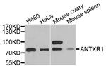 CMG2 Antibody in Western Blot (WB)