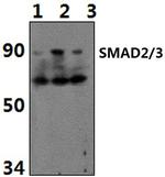 Acetyl-SMAD2/SMAD3 (Lys19) Antibody in Western Blot (WB)