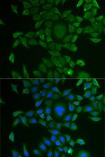 CCBL1 Antibody in Immunocytochemistry (ICC/IF)