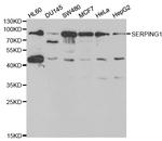 C1 inhibitor Antibody in Western Blot (WB)