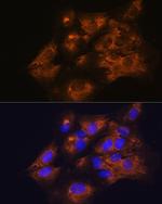 C1 inhibitor Antibody in Immunocytochemistry (ICC/IF)