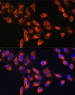 C1 inhibitor Antibody in Immunocytochemistry (ICC/IF)