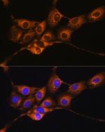 C1 inhibitor Antibody in Immunocytochemistry (ICC/IF)