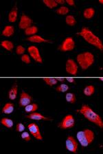 CBS Antibody in Immunocytochemistry (ICC/IF)